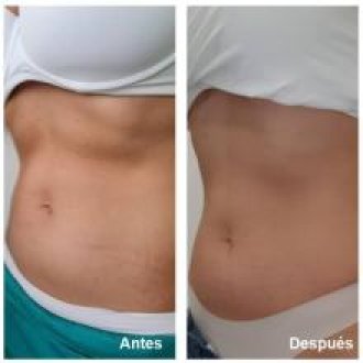 yesoterapia a domicilio